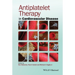 Antiplatelet Therapy in Cardiovascular Disease