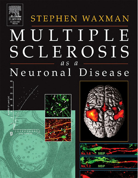 Multiple Sclerosis As A Neuronal Disease