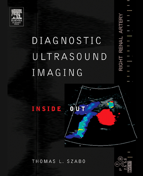 Diagnostic Ultrasound Imaging: Inside Out