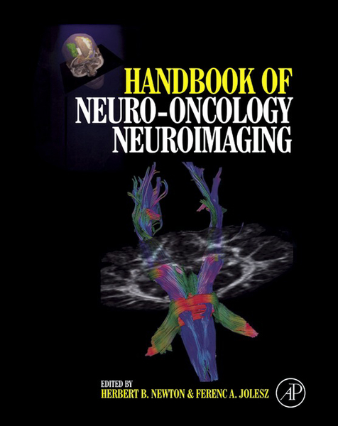 Handbook of Neuro-Oncology Neuroimaging