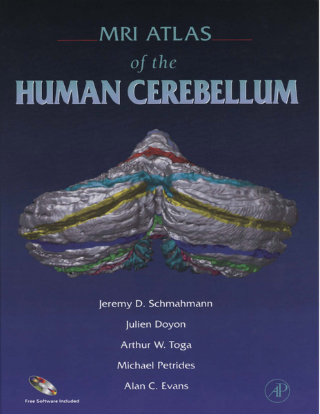 MRI Atlas of the Human Cerebellum