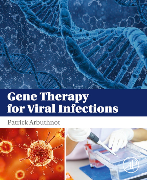 Gene Therapy for Viral Infections