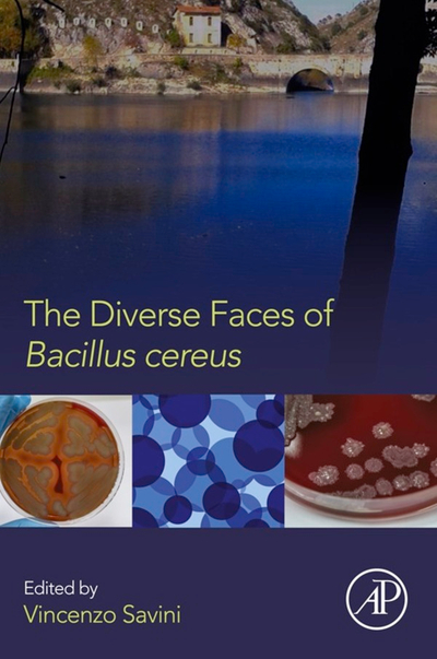 The Diverse Faces of Bacillus Cereus