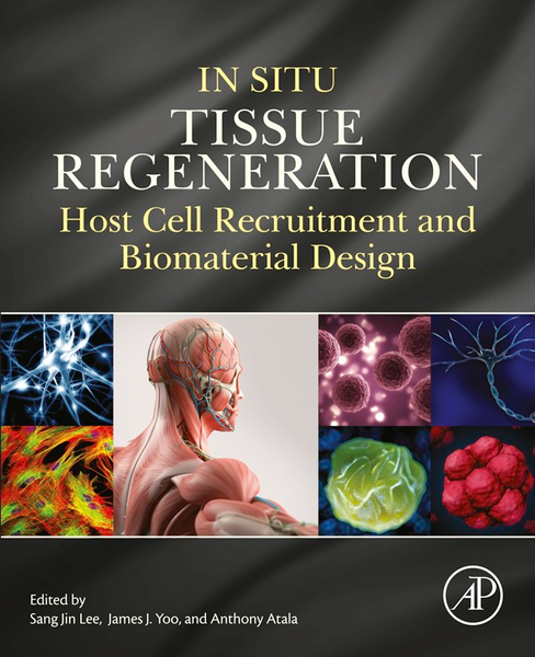 In Situ Tissue Regeneration