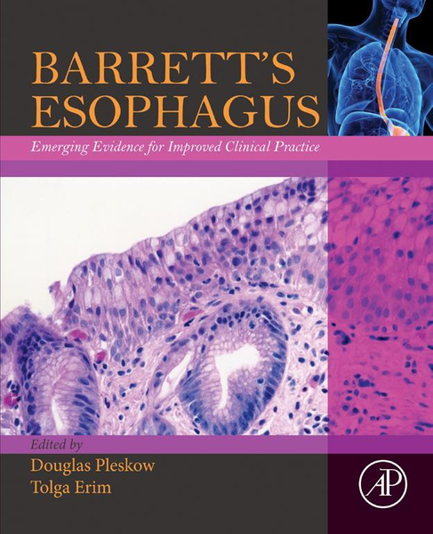 Barrett’s Esophagus