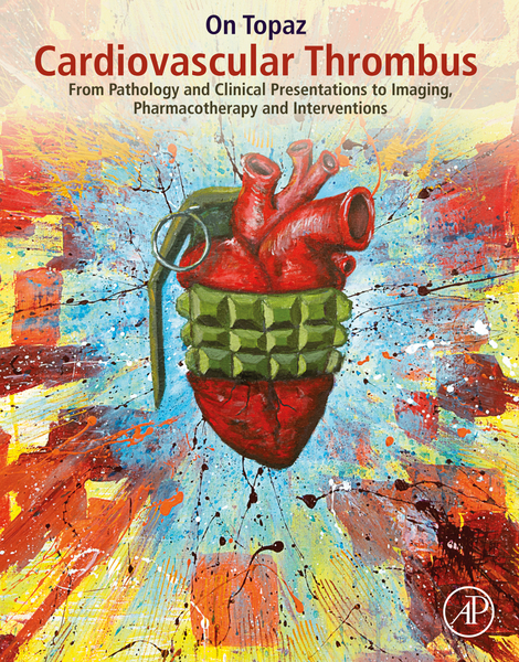 Cardiovascular Thrombus