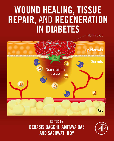 Wound Healing, Tissue Repair, and Regeneration in Diabetes