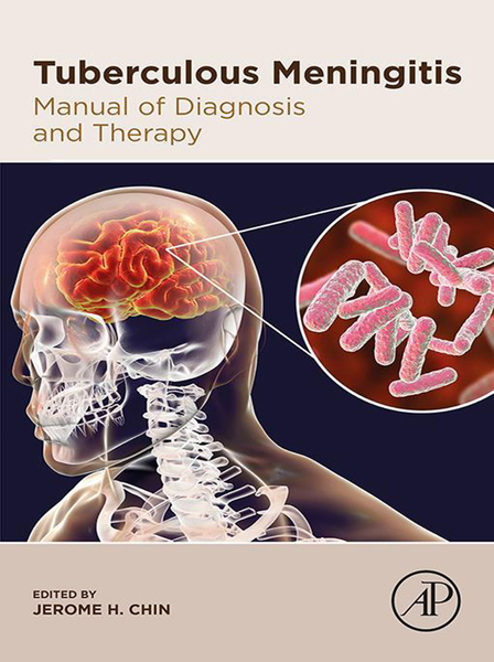 Tuberculous Meningitis