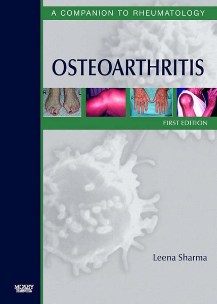 Osteoarthritis E-Book