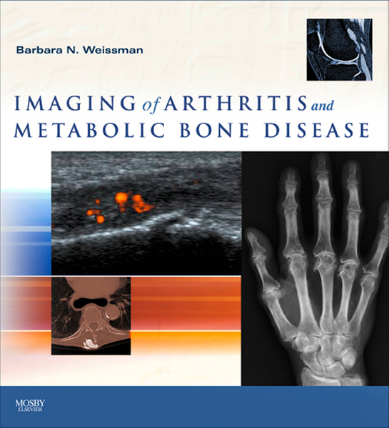 Imaging of Arthritis and Metabolic Bone Disease E-Book