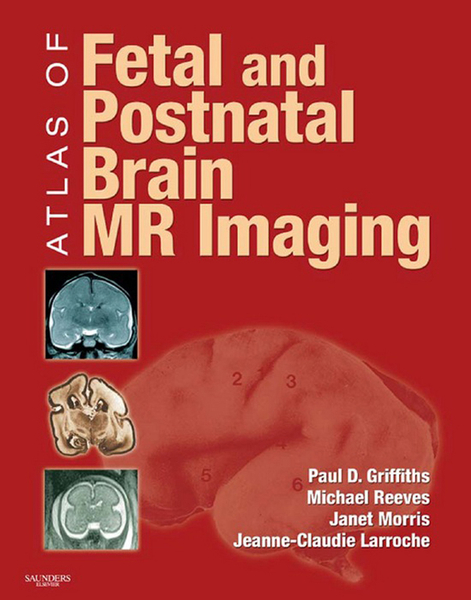 Atlas of Fetal and Postnatal Brain MR