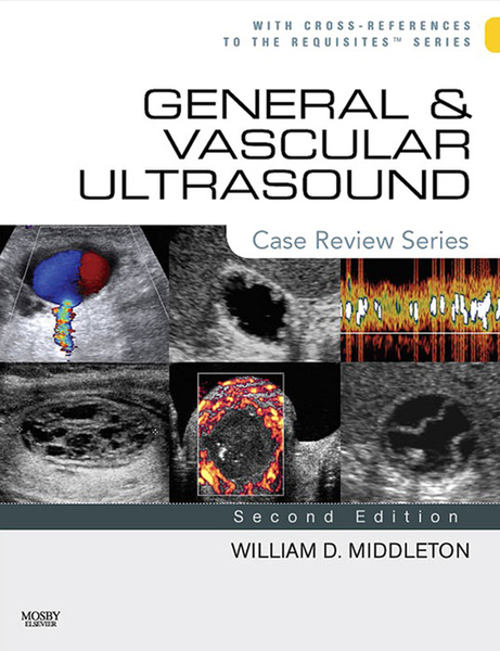 General and Vascular Ultrasound E-Book