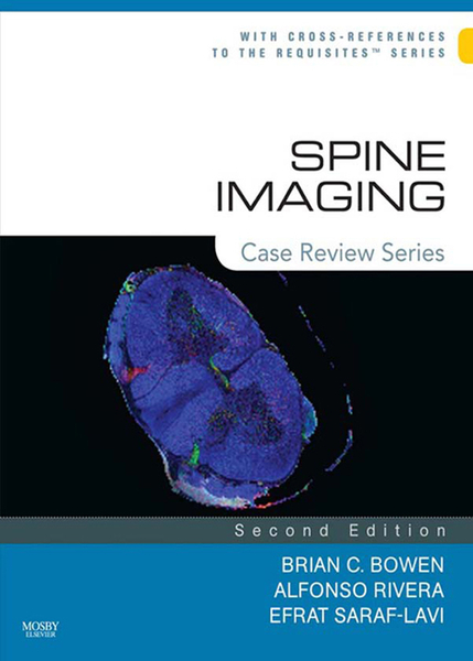 Spine Imaging E-Book