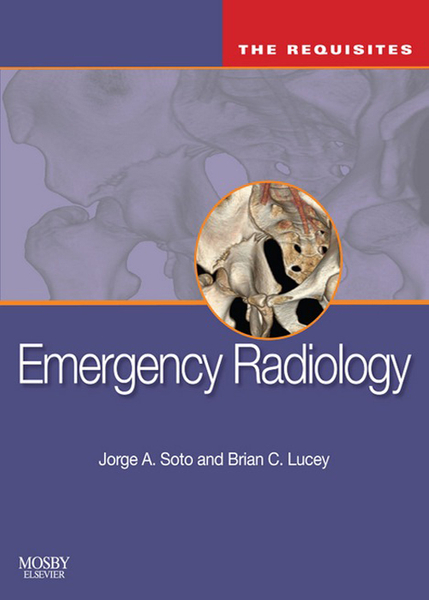 Emergency Radiology: The Requisites E-Book