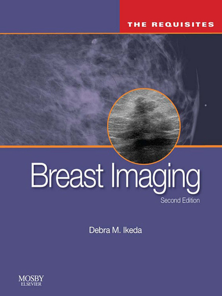 Breast Imaging: The Requisites E-Book