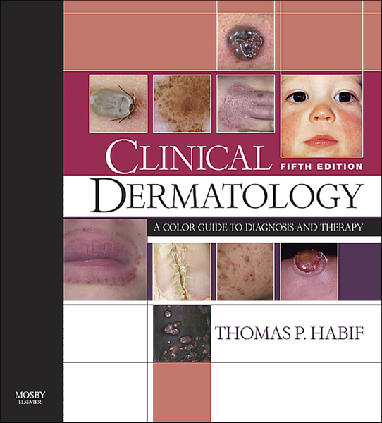 Clinical Dermatology E-Book