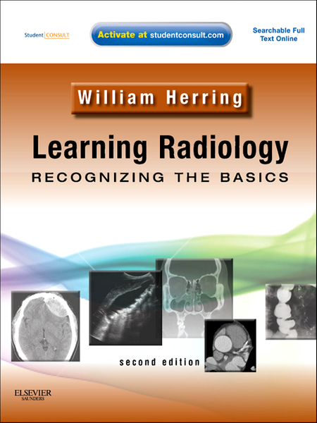 Learning Radiology: Recognizing the Basics E-Book