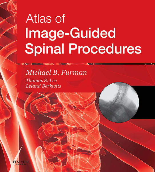 Atlas of Image-Guided Spinal Procedures E-Book