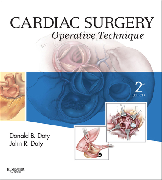 Cardiac Surgery E-Book