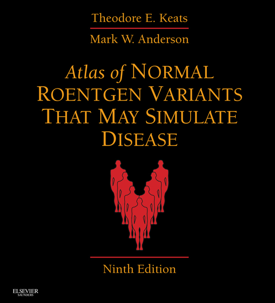 Atlas of Normal Roentgen Variants That May Simulate Disease E-Book