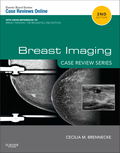 Breast Imaging: Case Review Series