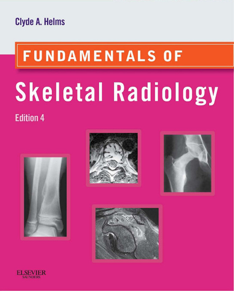 Fundamentals of Skeletal Radiology E-Book