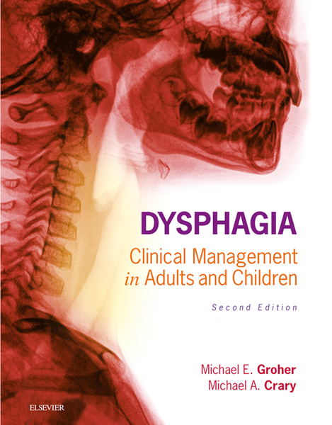 Dysphagia - E-Book