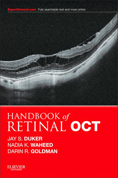 Handbook of Retinal OCT: Optical Coherence Tomography