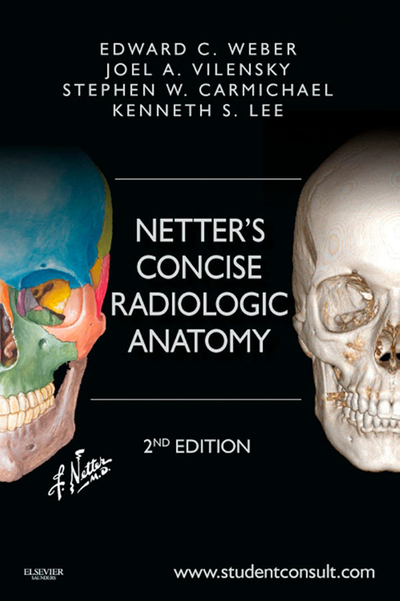 Netter's Concise Radiologic Anatomy E-Book