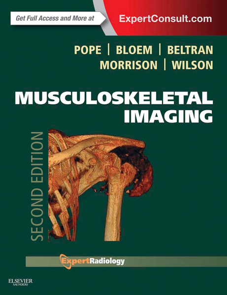 Musculoskeletal Imaging E-Book