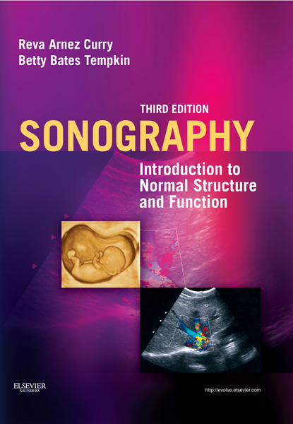 Sonography - E-Book