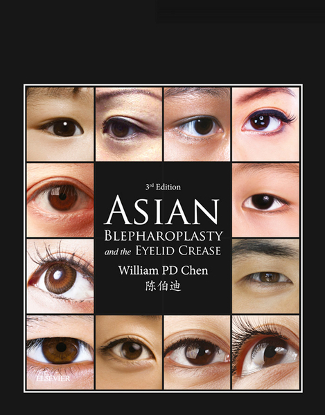 Asian Blepharoplasty and the Eyelid Crease E-Book