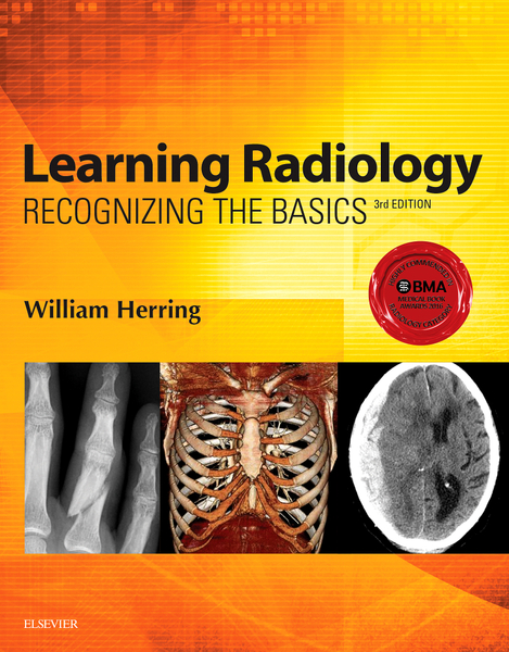 Learning Radiology E-Book