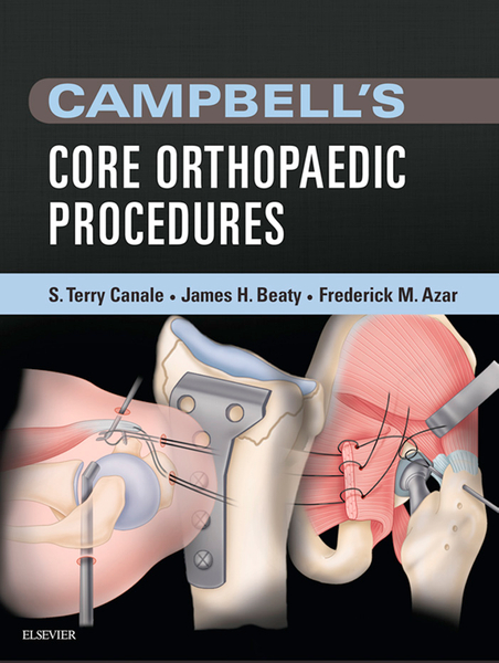 Campbell's Core Orthopaedic Procedures E-Book