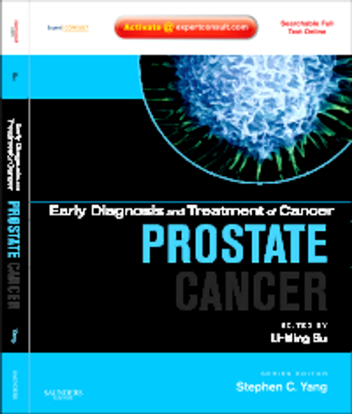 Early Diagnosis and Treatment of Cancer Series: Prostate Cancer E-Book