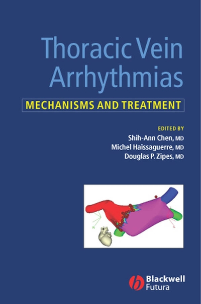 Thoracic Vein Arrhythmias