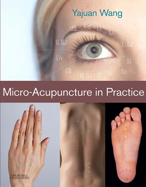 Micro-Acupuncture in Practice