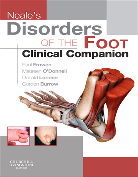 Neale's Disorders of the Foot