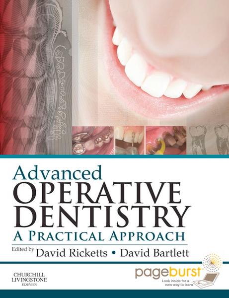 Advanced Operative Dentistry