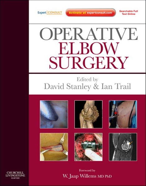 Operative Elbow Surgery E-Book