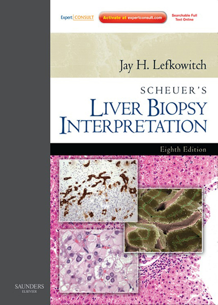 Scheuer's Liver Biopsy Interpretation E-Book