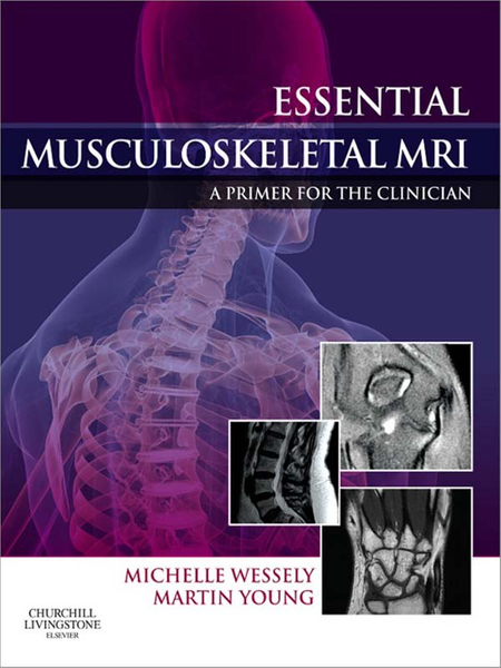 Essential Musculoskeletal MRI E-Book