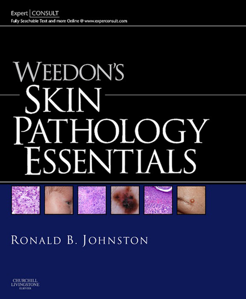 Weedon's Skin Pathology Essentials E-Book