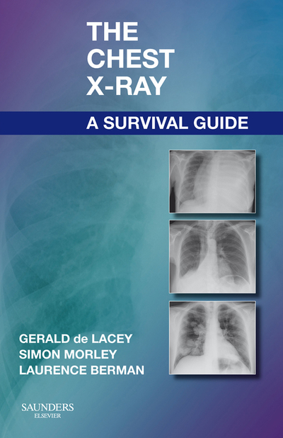 The Chest X-Ray: A Survival Guide