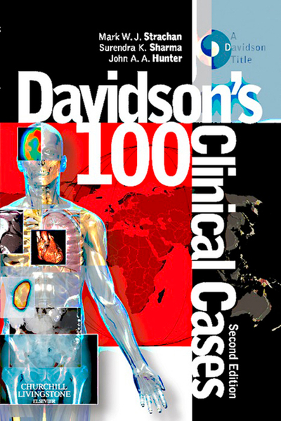 Davidson's 100 Clinical Cases E-Book