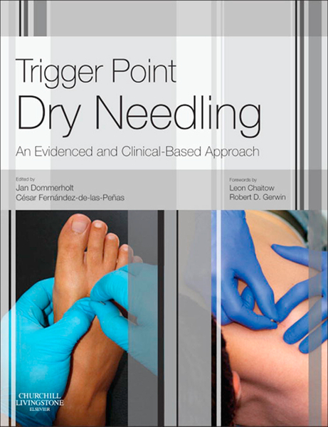 Trigger Point Dry Needling E-Book