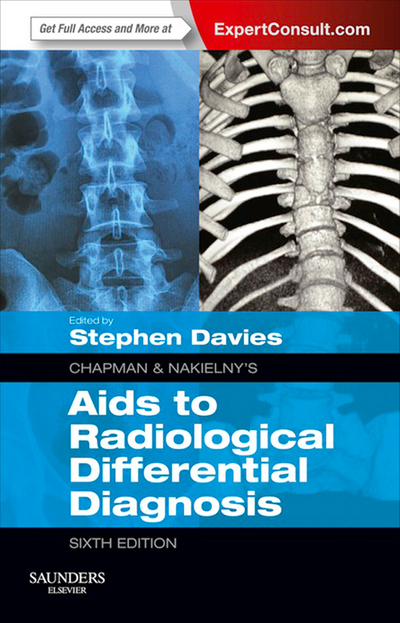 Chapman & Nakielny's Aids to Radiological Differential Diagnosis E-Book