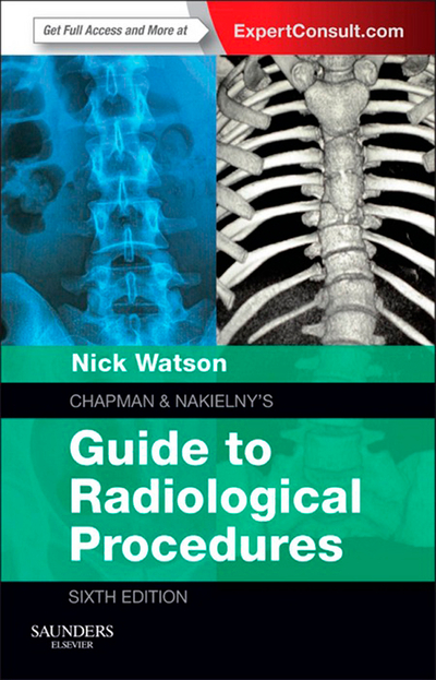 Chapman & Nakielny's Guide to Radiological Procedures E-Book