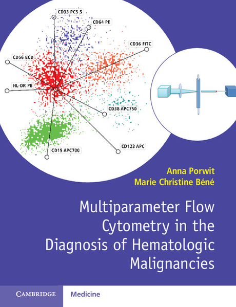 Multiparameter Flow Cytometry in the Diagnosis of Hematologic Malignancies