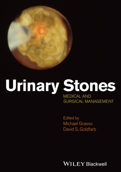 Urinary Stones